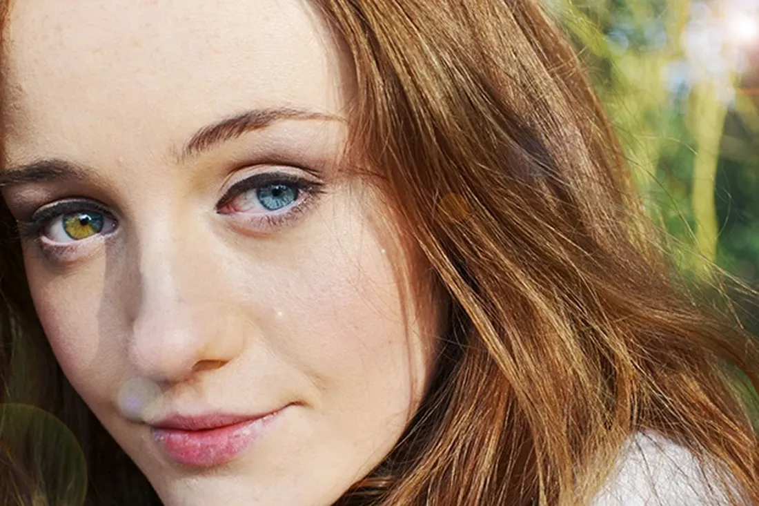 Глаза разного цвета — дар природы или тревожный сигнал?