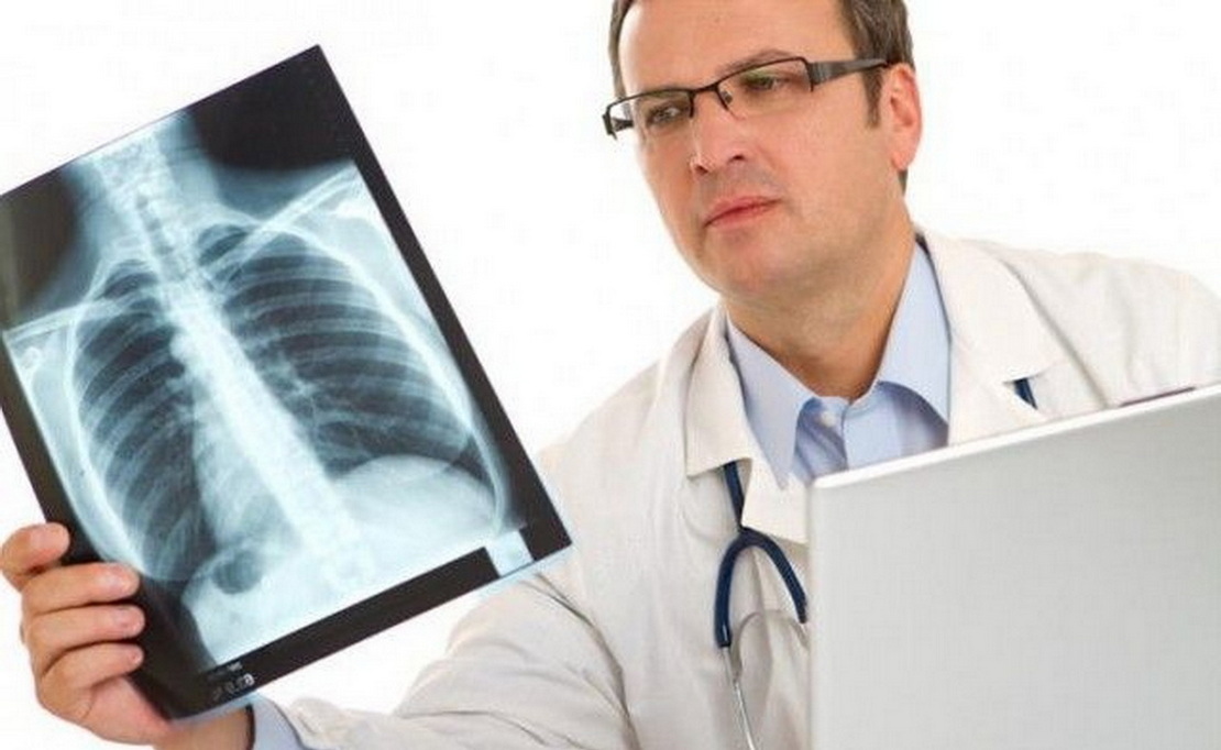 Пневмония после 60 лет: скрытые симптомы и высокий риск осложнений