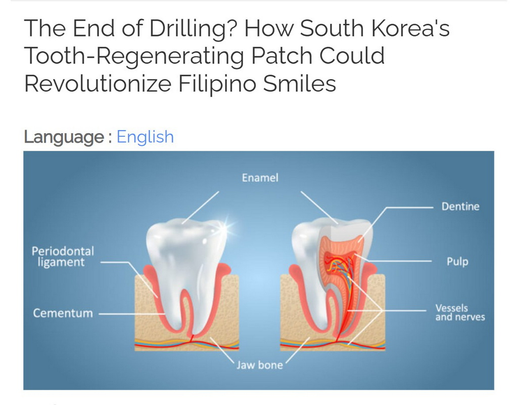 Разработана технология выращивания новых зубов с помощью пластыря